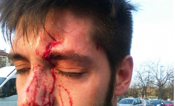 Aggredito dopo la partita: nuova operazione