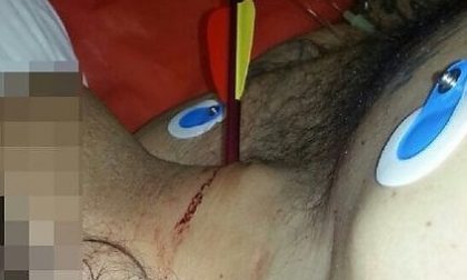 In ospedale con una freccia nel collo