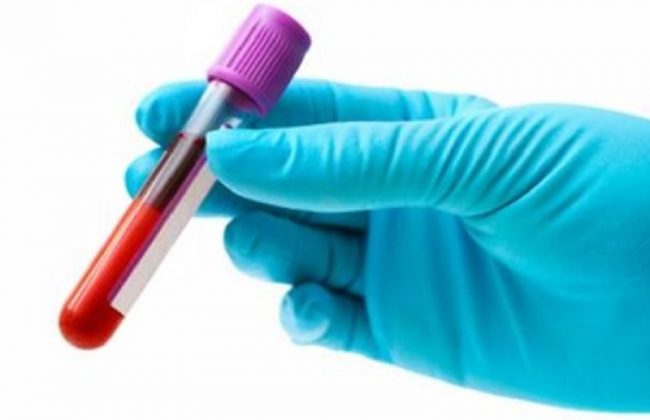 Sangue infetto: medicinale ritirato
