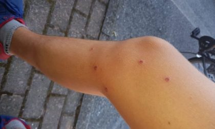 Ragazzino preso a fucilate da due “amici”: undici colpi alle gambe