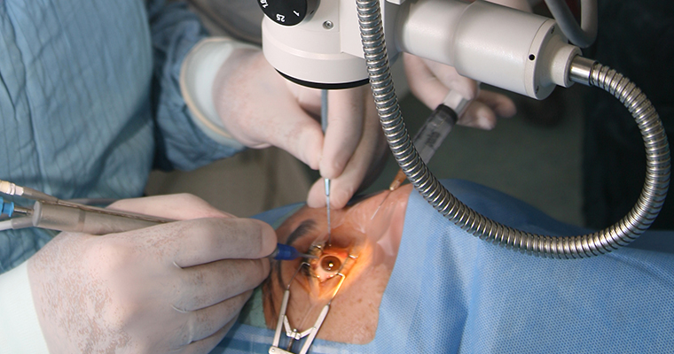 Operate di cataratta quattro donne perdono un occhio