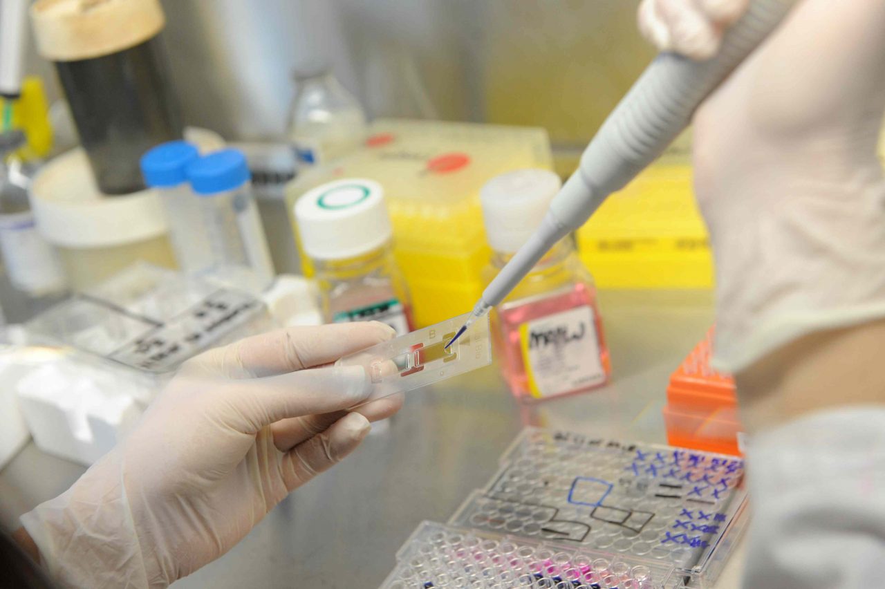 Lotta ai tumori del sangue: da Torino importanti passi avanti