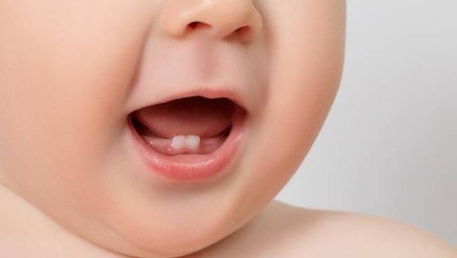 Gel per dentizione con zuccheri e alcol: ecco l’elenco dei prodotti pericolosi