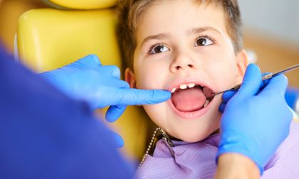 Malocclusioni dentali nei bambini: da cosa dipendono e come si curano