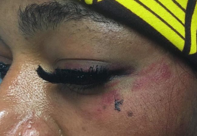 “Sei lesbica, ti ucciderò, grave aggressione omofoba