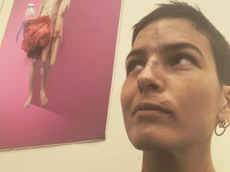 L’ex Miss Italia dopo l’operazione all’ospedale di Chivasso
