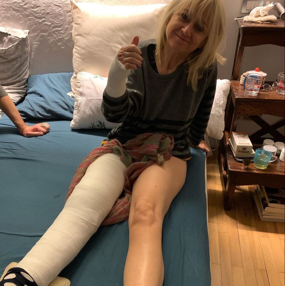 Luciana Littizzetto cade per strada e si rompe rotula e polso