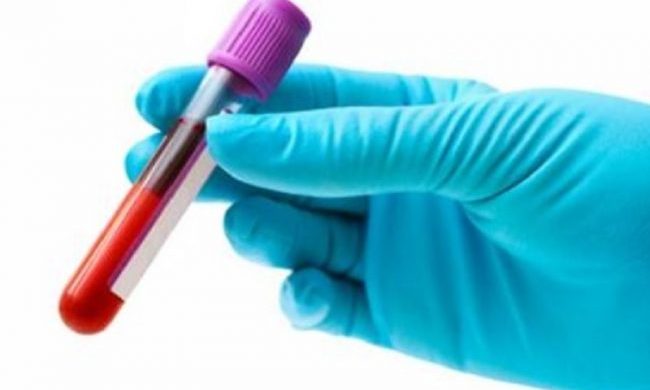 Psicosi Coronavirus a Chivasso. Si trattava di un cinese colto da ictus