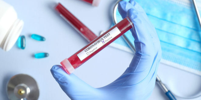Coronavirus, primi due decessi in Alto Canavese