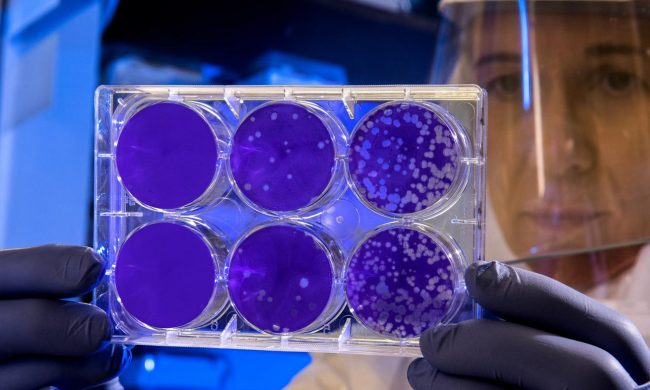 Coronavirus, Cirio: “Tampone su tutti gli operatori sanitari”