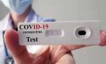 Salizzoni: "Troppi test sierologici privati rischiano di mettere in ginocchio la sanità pubblica"