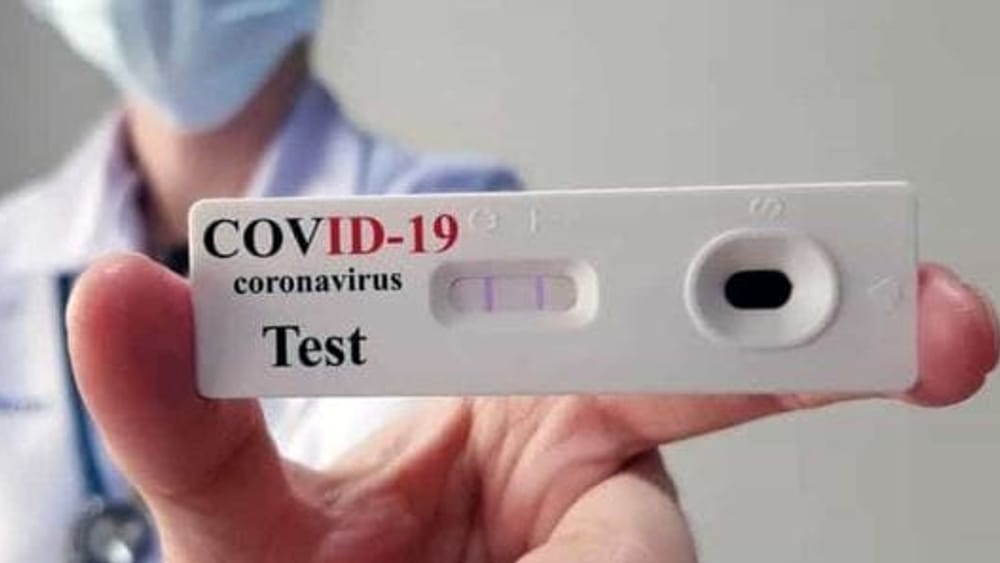 La Regione approva il protocollo per la gestione dei test sierologici