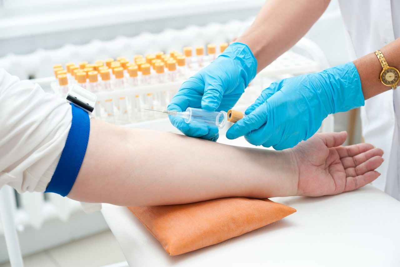 Prelievi del sangue solo con prenotazione online o telefonica