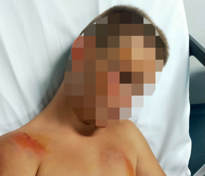 Investe bambino e scappa, si cercano testimoni