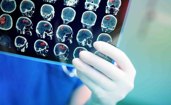 A Colleretto un congresso dedicato alla diagnostica per immagini