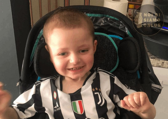 Nikolas non ce l’ha fatta, si è spento il piccolo cuorgnatese di 3 anni che combatteva contro una malattia rara